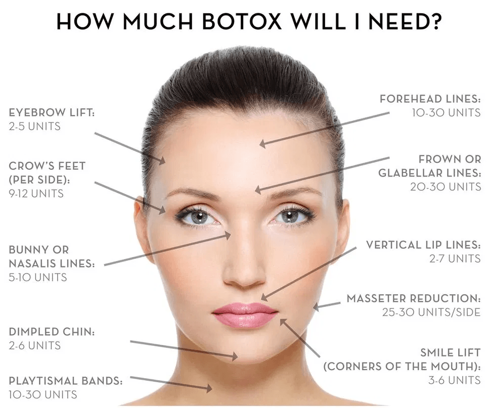 how much botox will I need illustration