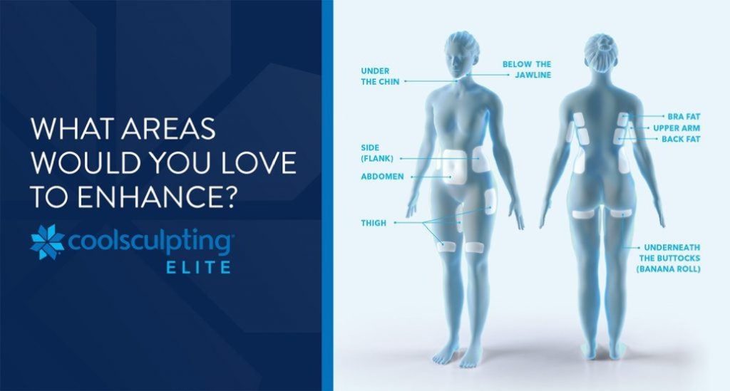 Diagram of areas improved by CoolSculpting Elite