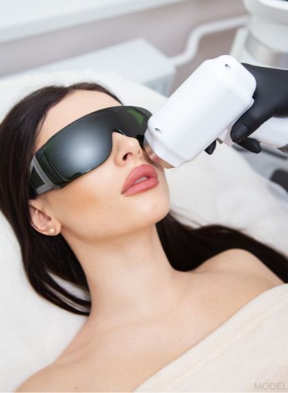 Woman receiving laser hair removal (MODEL)